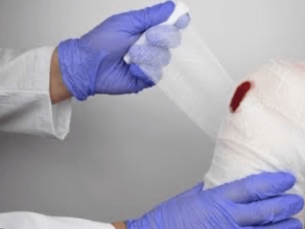 怪我した膝に包帯を巻いている